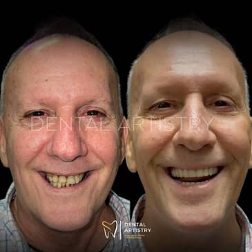 Slider image (9) Dental Artistry Dental Center